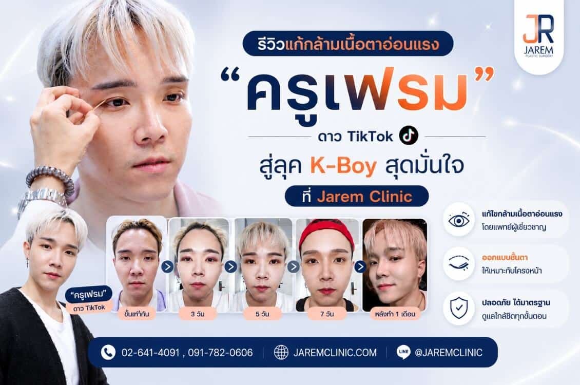 รีวิวแก้กล้ามเนื้อตาอ่อนแรงผู้ชาย สลัดลุค “ตาหมาหงอย” สู่ดวงตาสดใสสไตล์ K-Boy โดยคุณหมอยุ้ย จาเรมคลินิก
