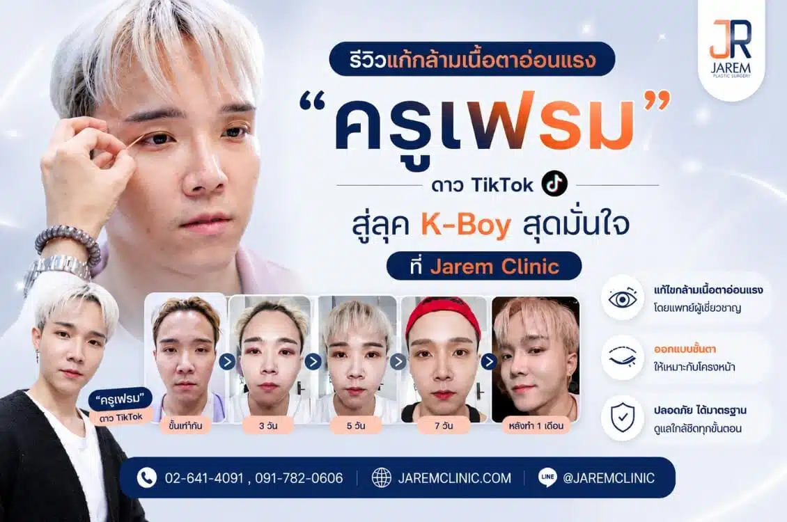 รีวิวแก้กล้ามเนื้อตาอ่อนแรงผู้ชาย สลัดลุค “ตาหมาหงอย” สู่ดวงตาสดใสสไตล์ K-Boy โดยคุณหมอยุ้ย จาเรมคลินิก