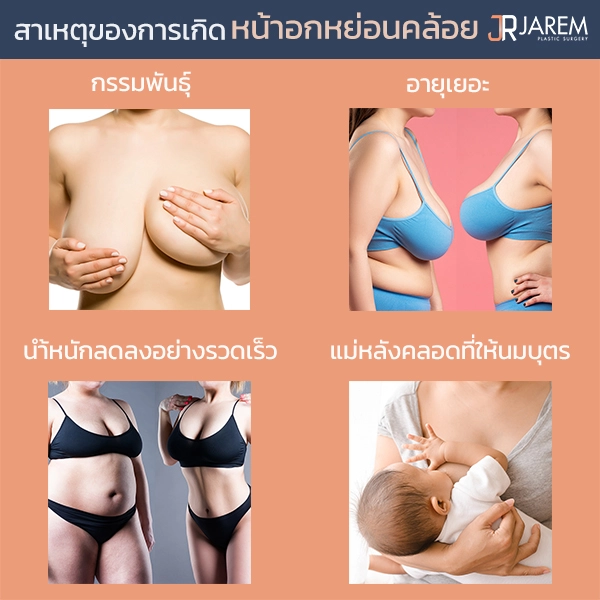 สาเหตุที่ทำให้หน้าอกคล้อย