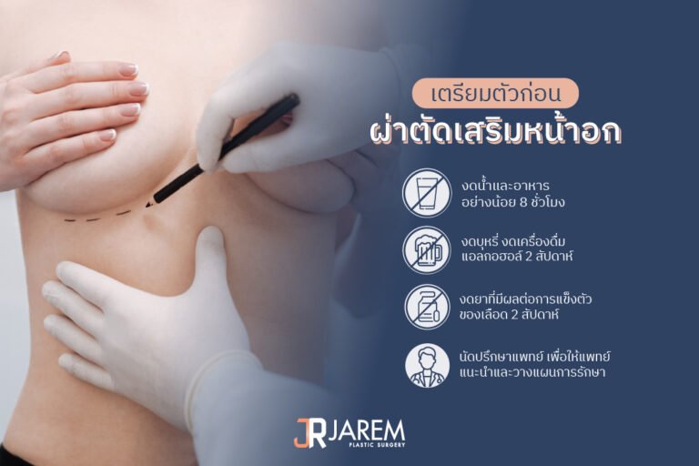 การเตรียมตัวก่อนการเข้ารับการผ่าตัดเสริมหน้าอก