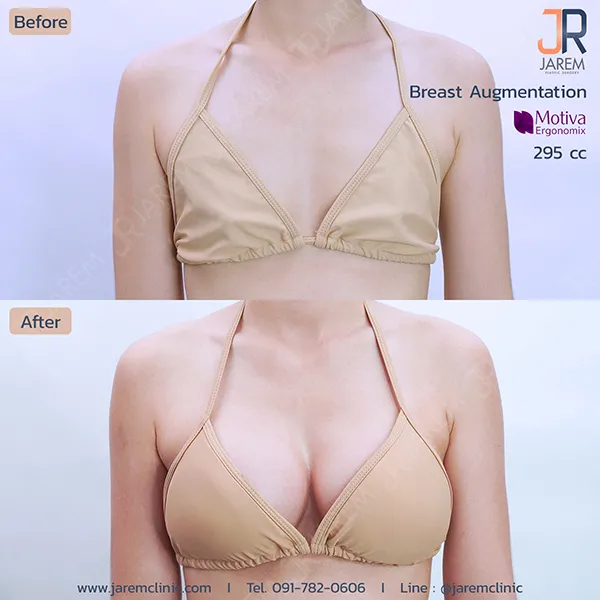 ทำหน้าอก