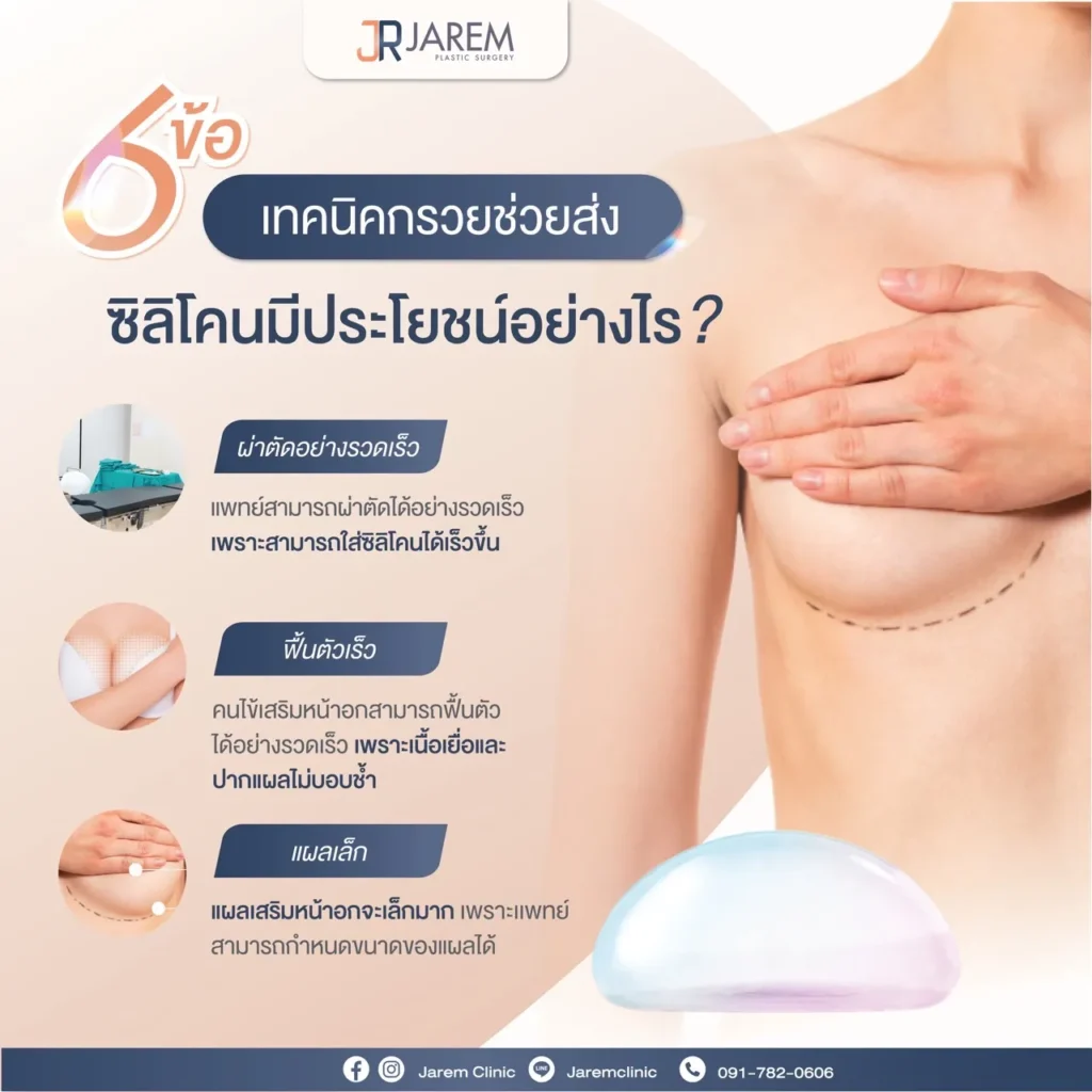 การใส่ซิลิโคนหน้าอกด้วย Funnel