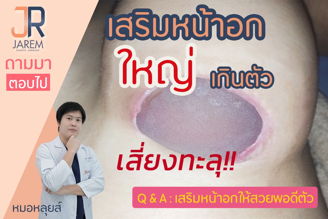 ปกบทความซิลิโคนทะลุ