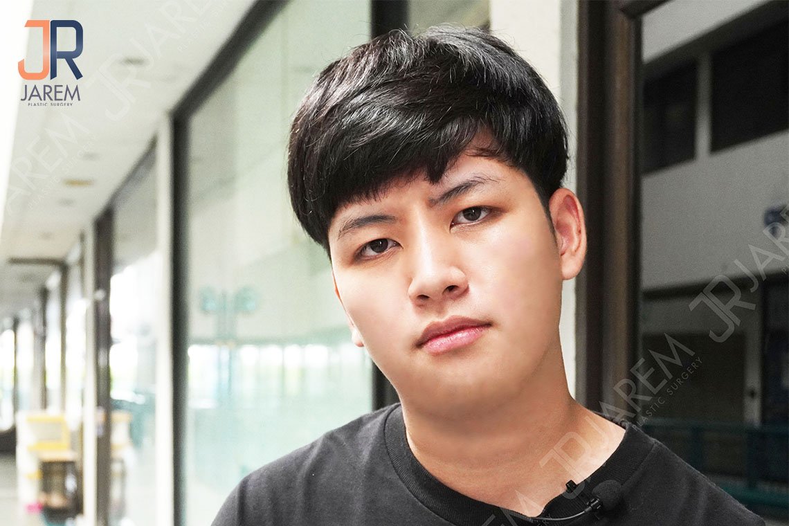กล้ามเนื้อตาอ่อนแรงแต่กำเนิด