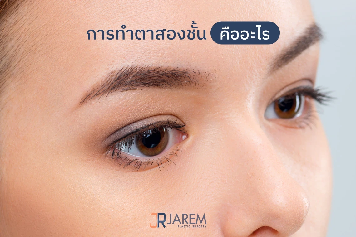 การทำตาสองชั้นคือ