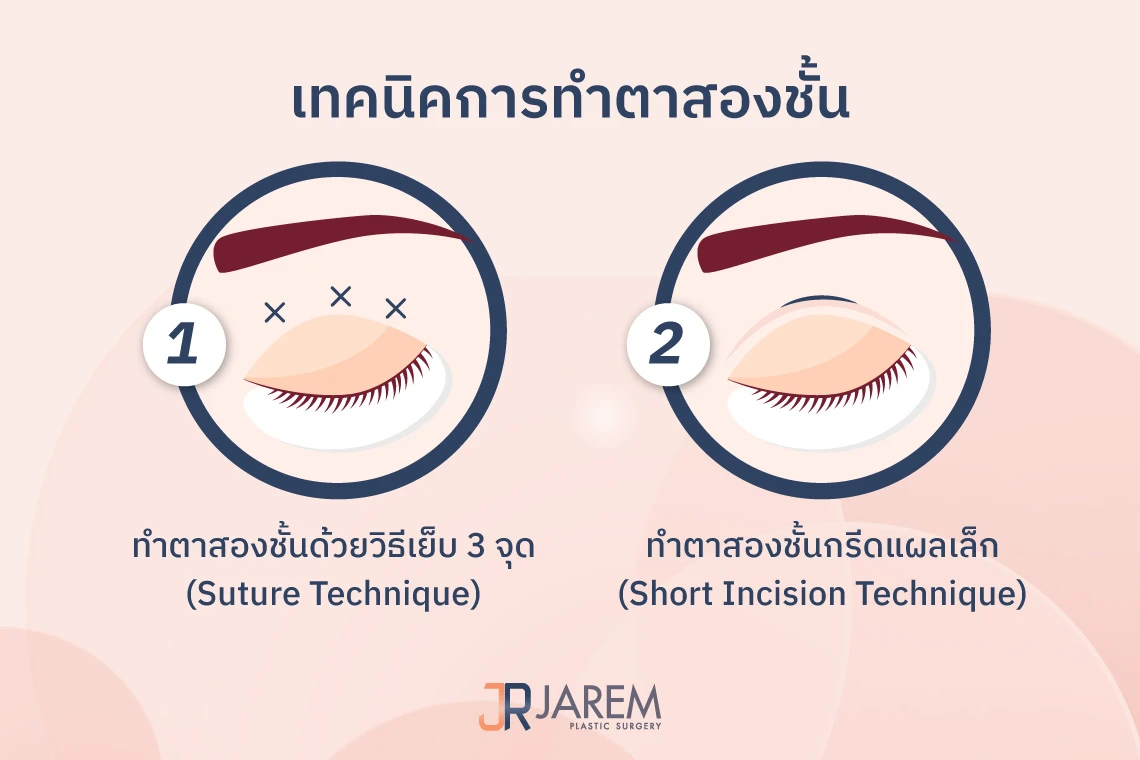 เทคนิคการทำตาสองชั้น