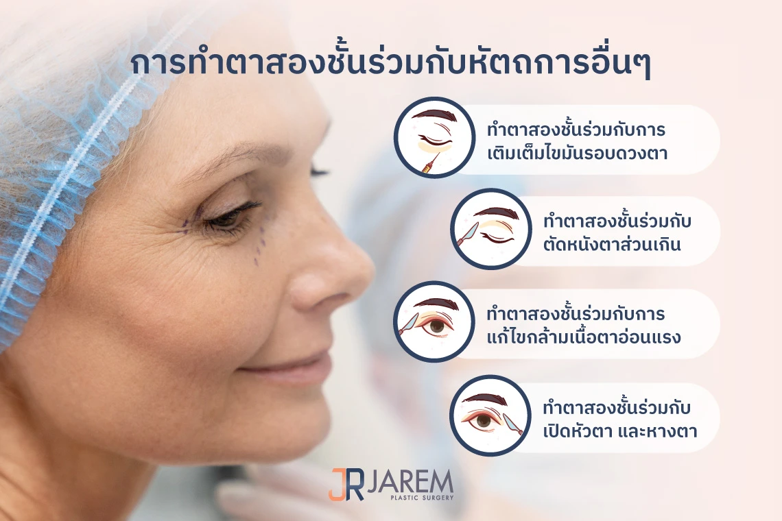 ศัลยกรรมตาสองชั้น