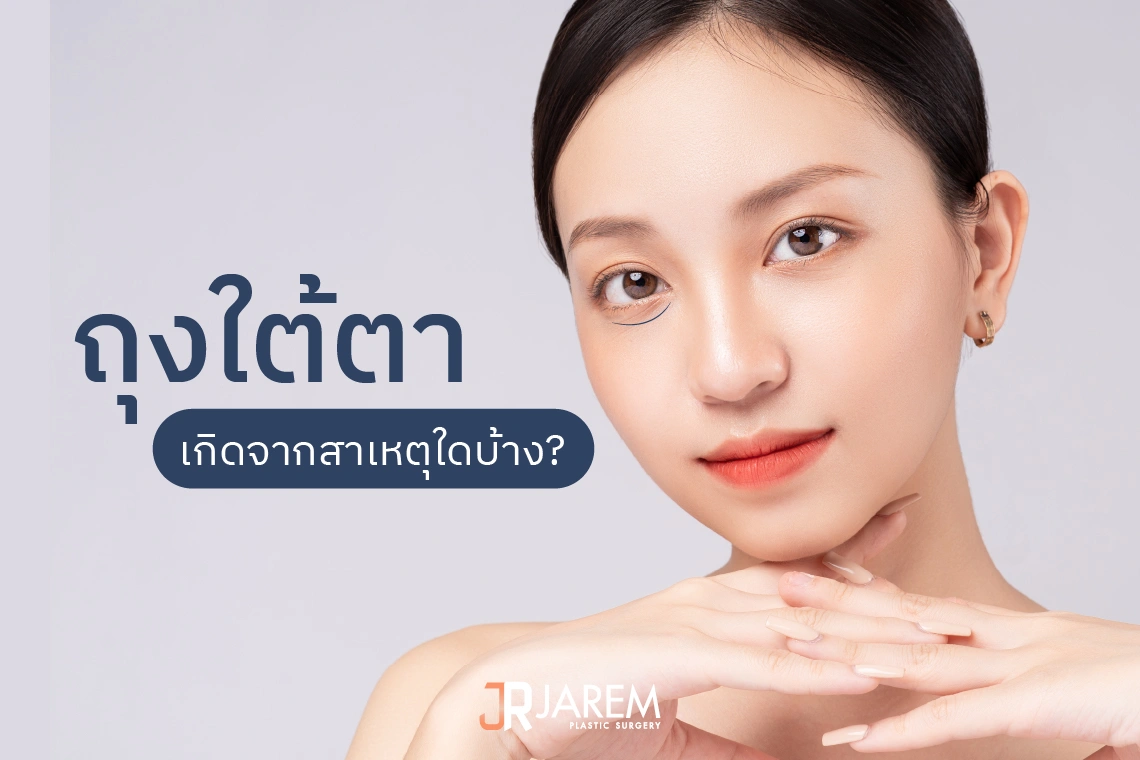 ถุงใต้ตาเกิดจากอะไร