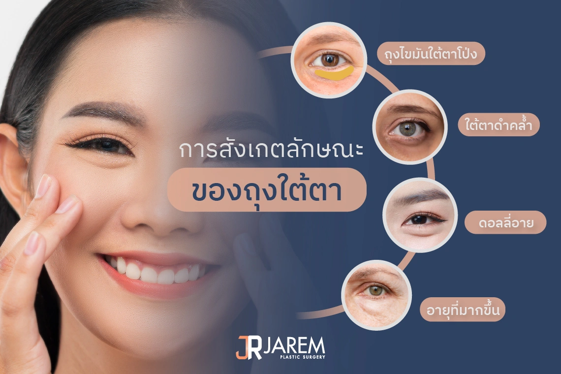 ลักษณะของถุงใต้ตา