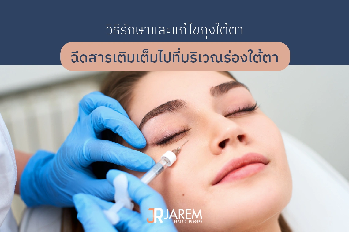 ฉีด filler ร่องใต้ตา แก้ถุงใต้ตา