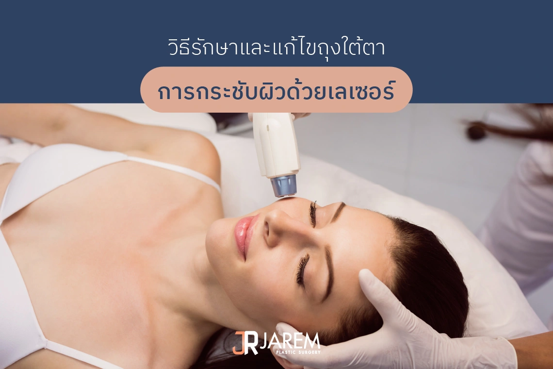 กระชับถุงใต้ตาด้วยเลเซอร์
