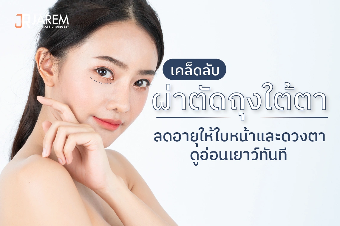 ปกบริการผ่าตัดถุงใต้ตา