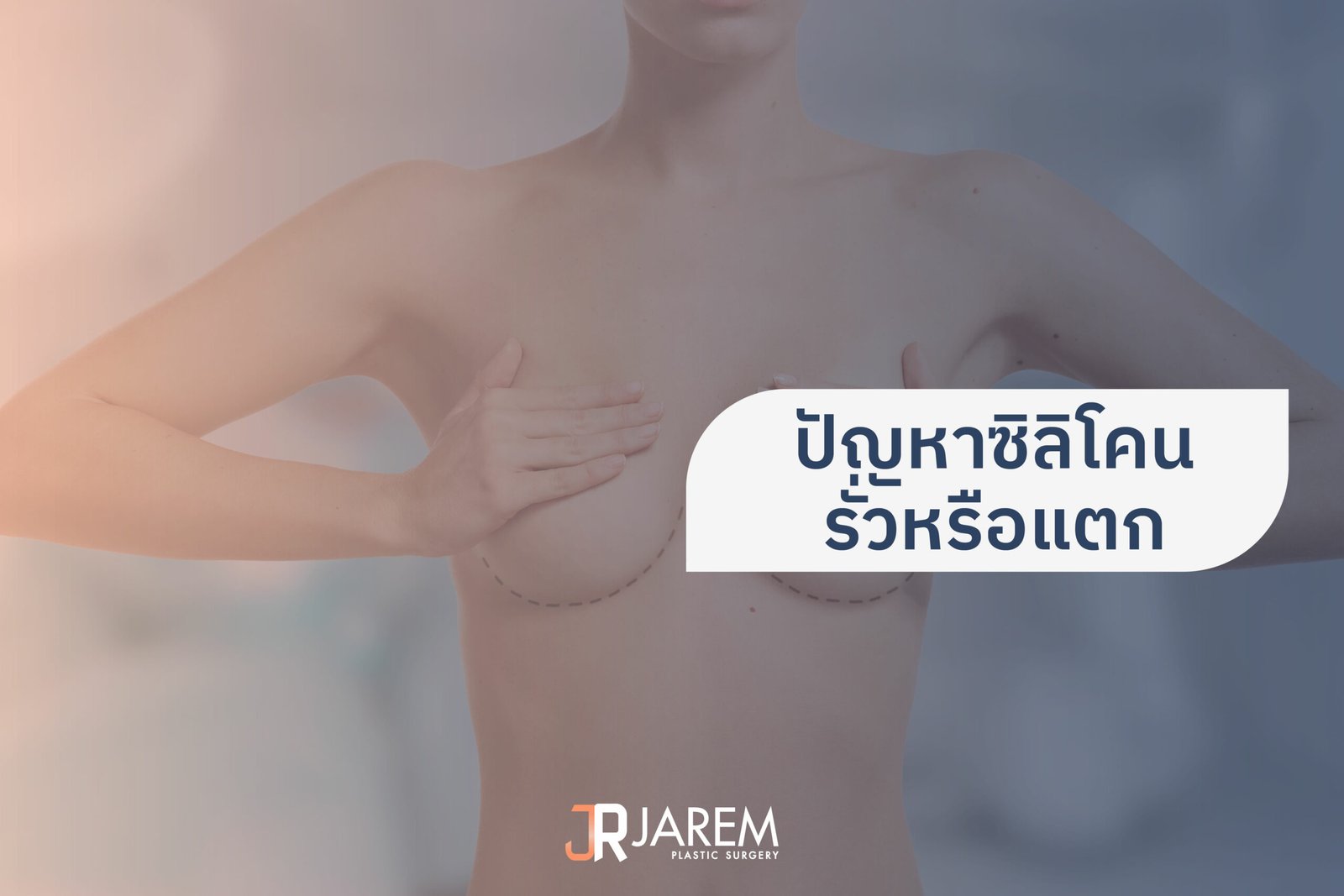 ปัญหาซิลิโคนรั่วหรือแตก