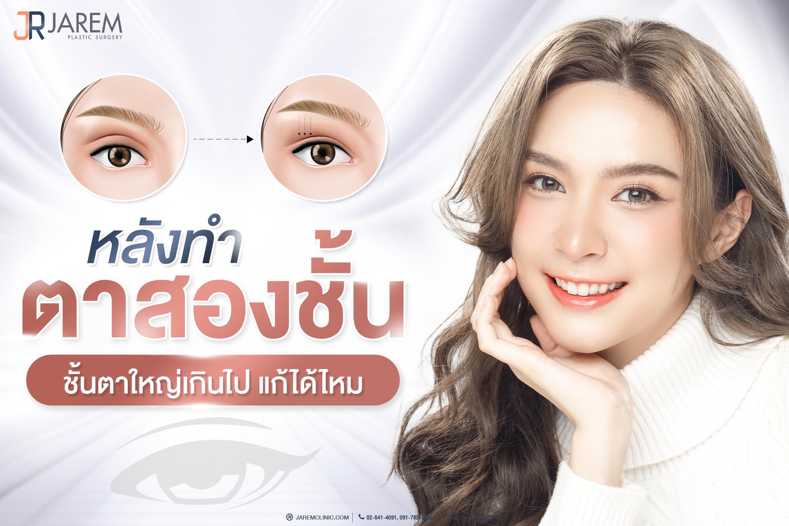 หลังทำตาสองชั้น ชั้นตาใหญ่เกินไป แก้ได้ไหม