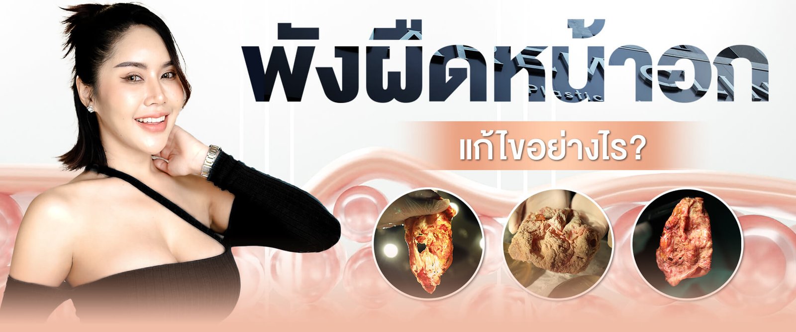 บริการ - แก้ไขพังผืดหน้าอก