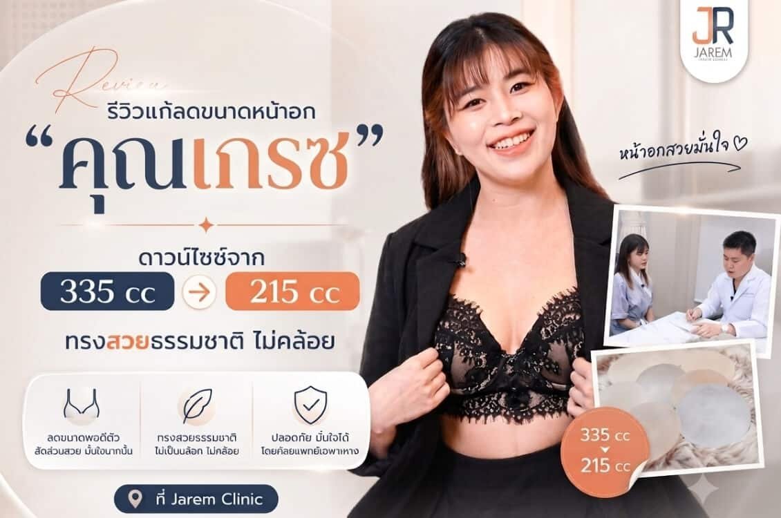 รีวิวแก้ลดขนาดหน้าอก คุณเกรซ จาก 335 cc สู่ Motiva Demi 215 cc ที่ Jarem Clinic